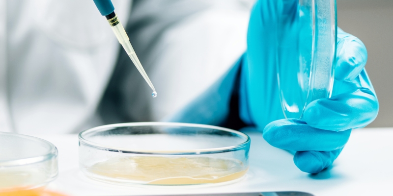 microbiología de la cadena alimentaria