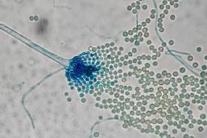 aspergillus