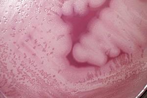 seguridad alimentaria