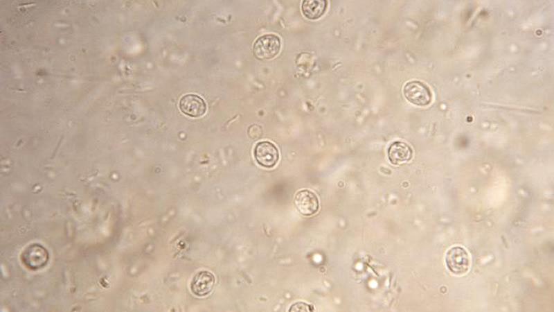cryptosporidium