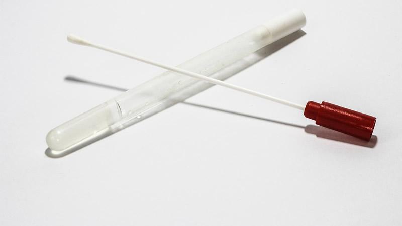 seguridad alimentaria