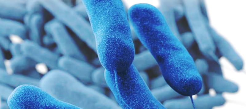 legionella