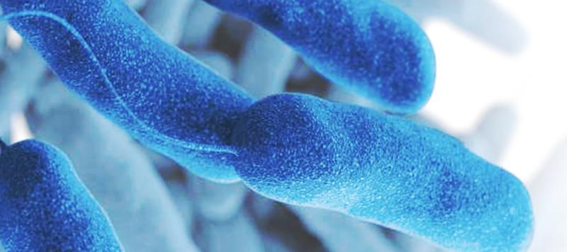 legionella