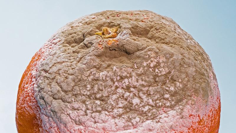 seguridad alimentaria