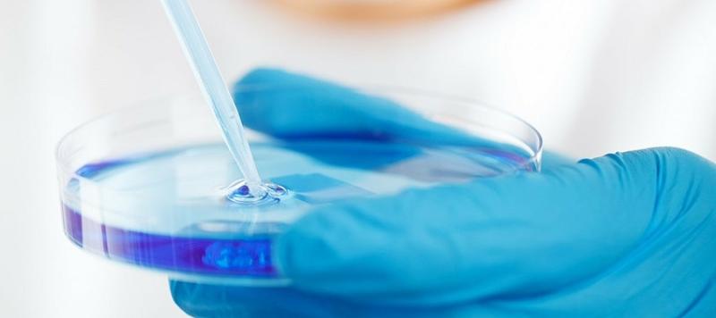 listeria monocytogenes