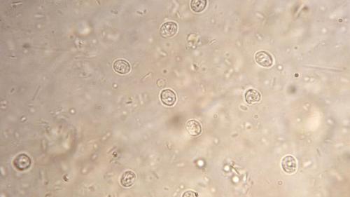 cryptosporidium