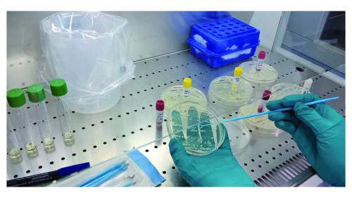 tratamiento del agua