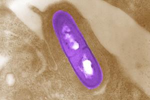 Listeria
