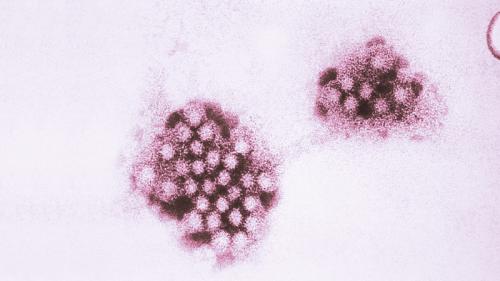norovirus