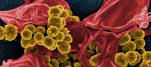 staphylococcus aureus