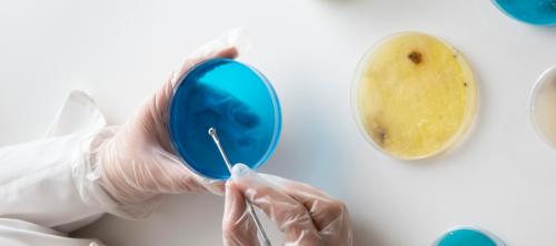 microbiologia alimentaria