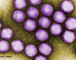 tratamiento del agua