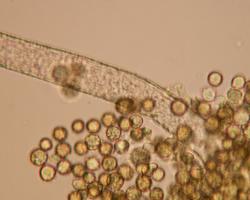 micotoxinas