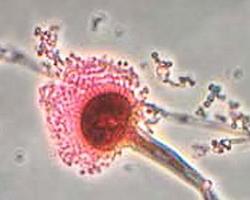 micotoxinas