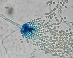 aspergillus