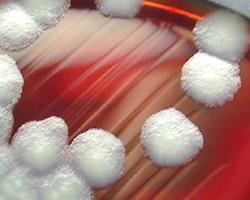 bacillus cereus