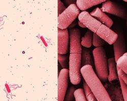 seguridad alimentaria