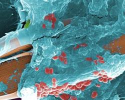 biofilm