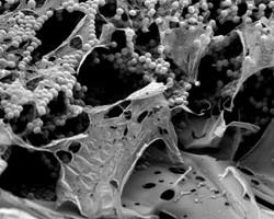 biofilm