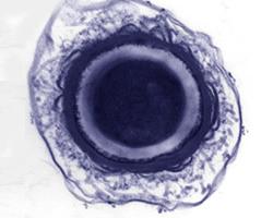 C. botulinum