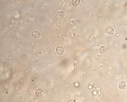cryptosporidium