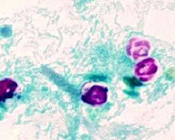 Cryptosporidium