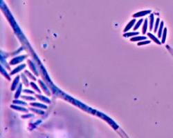 micotoxinas