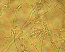 micotoxinas