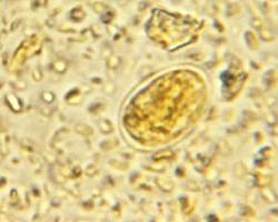 giardia
