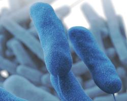 legionella