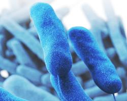 legionella