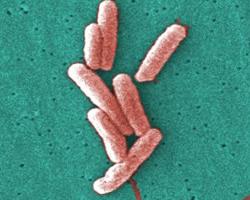 legionella