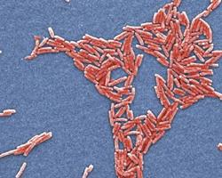 legionella