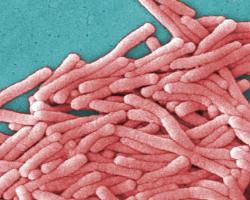 legionella