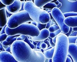 legionella