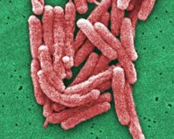 legionella