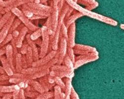 legionella