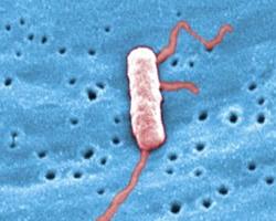 legionella