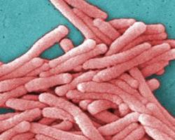 legionella