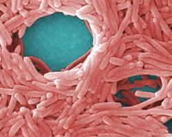 legionella