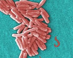 legionella