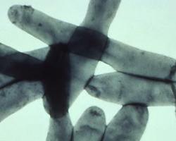 legionella
