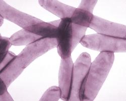legionella