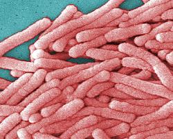 legionella