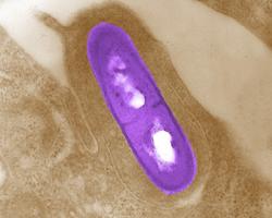 Listeria