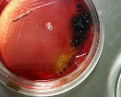 listeria