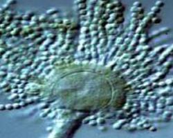 micotoxinas