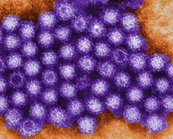 norovirus