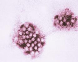 norovirus