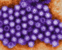norovirus